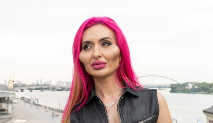 Una mujer se hace viral por tener los pómulos más grandes del mundo